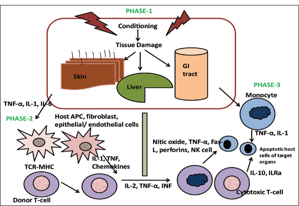 Irradiation of blood components in combating transfusion associated graft versus host disease (TA- GvHD)