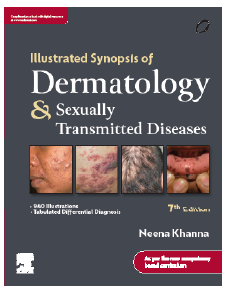 Illustrated synopsis of dermatology & sexually transmitted diseases