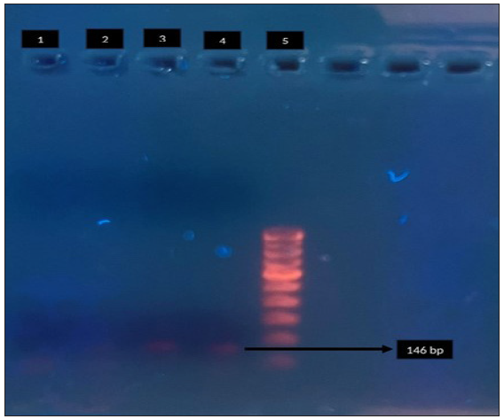 Macrolide and fluoroquinolone resistance associated mutations in Mycoplasma genitalium in men who have sex with men attending STI clinic: A pilot study from India