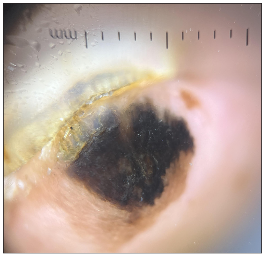 Rule-based dermatological strategies: From diagnosis to treatment