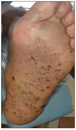 The rainbow pattern in dermoscopy: A panorama of Kaposi’s and non-Kaposi’s lesions