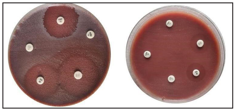 Antibiotic resistance and biofilm formation in Cutibacterium acnes: A descriptive cross-sectional study