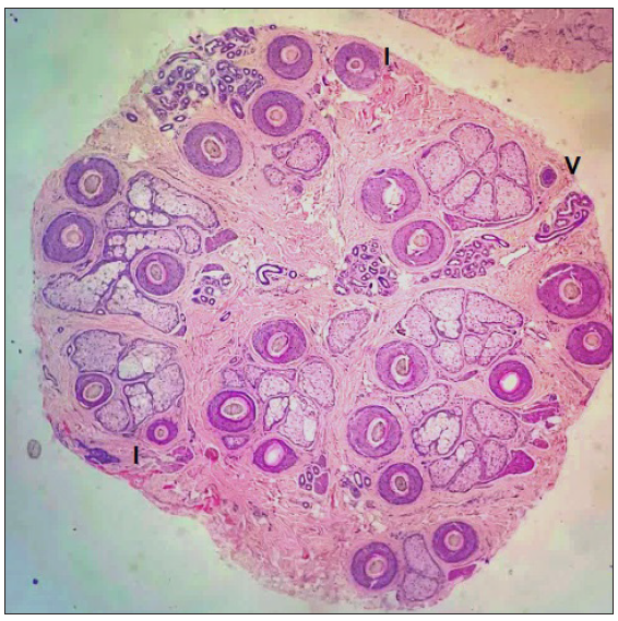 Normal hair follicle counts from scalp biopsy of Indian ethnicity: A cross-sectional study