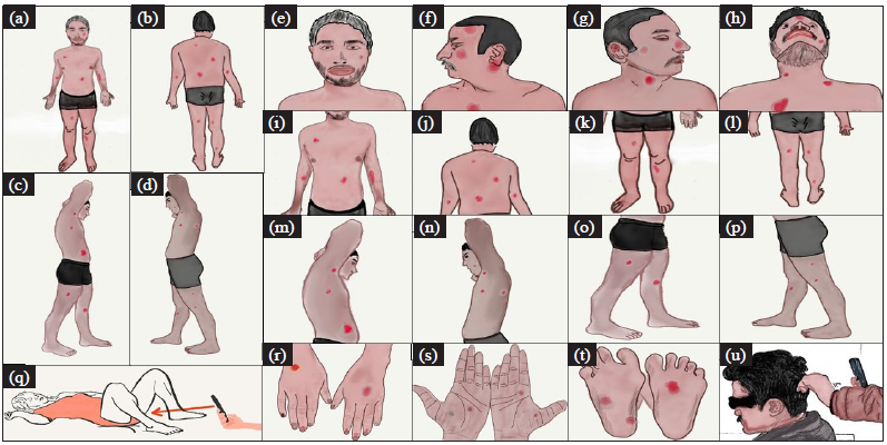 Construction and validation of an audio-visual tool to instruct caregivers of patients with pemphigus in photographing skin and oral cavity lesions during tele-consultation: A cross-sectional study