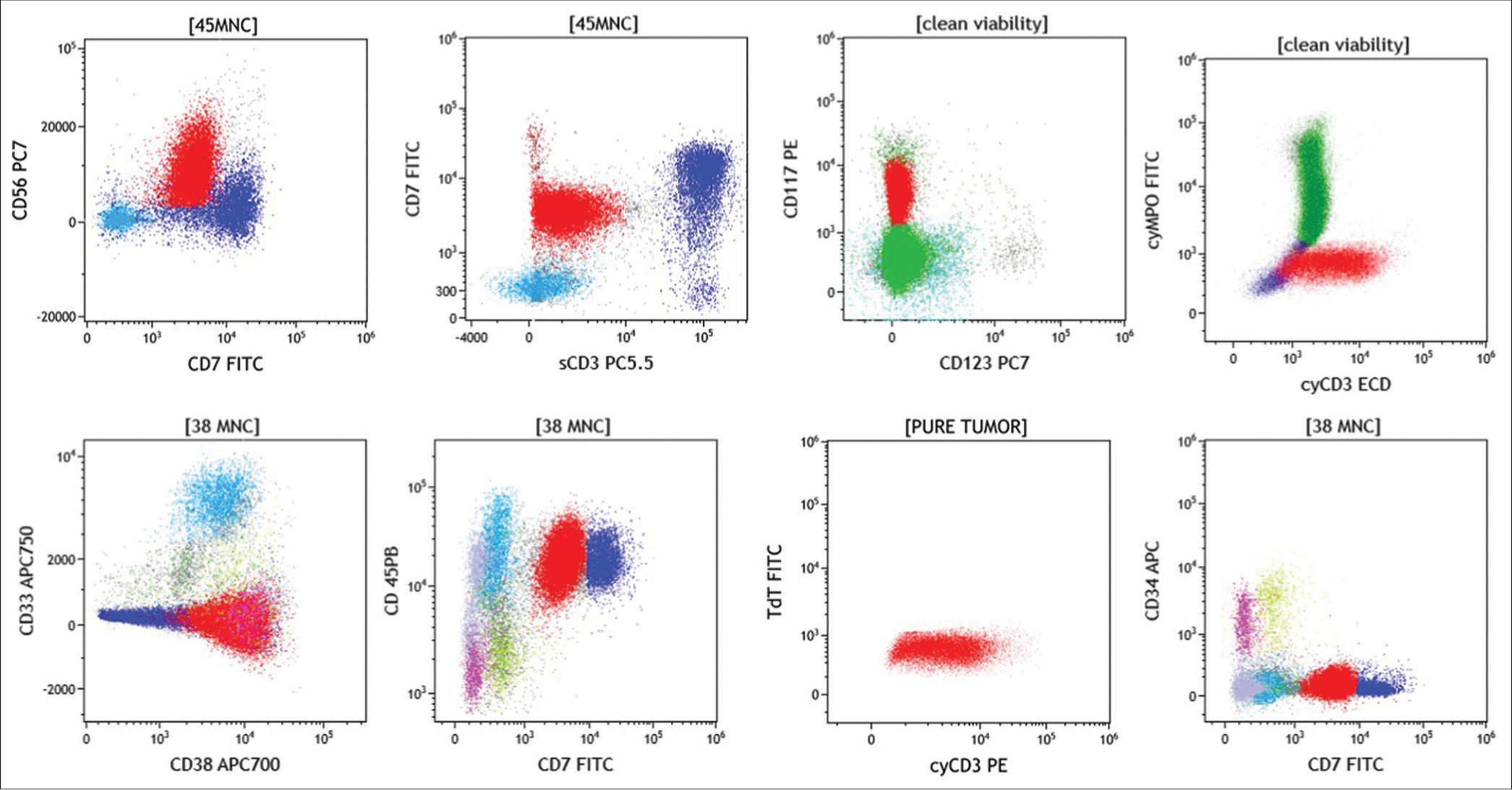 Can targeted therapy improve outcome in Epstein–Barr virus-negative aggressive natural killer cell leukemia: A case report