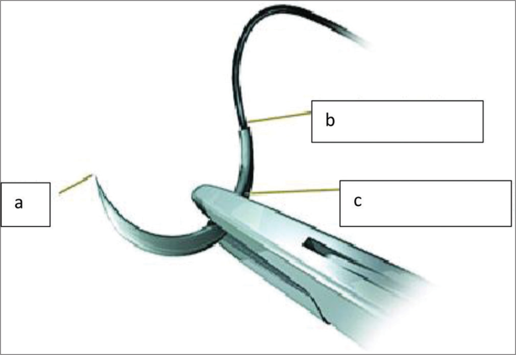 Suturing techniques