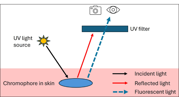 Ultraviolet fluorescence dermoscopy in dermatology