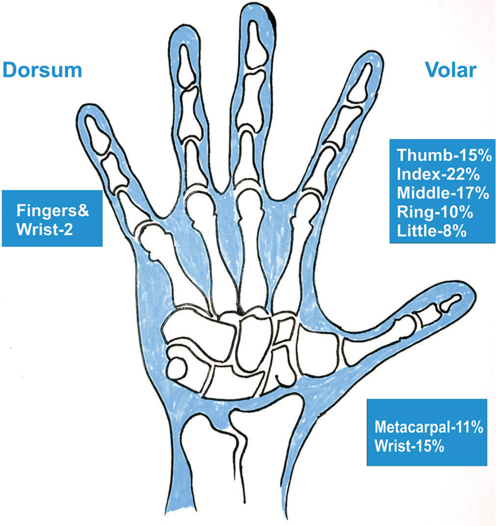 Giant cell tumor of the tendon sheath: A critical review of current diagnostic and therapeutic approaches with treatment recommendations for hand and foot lesions