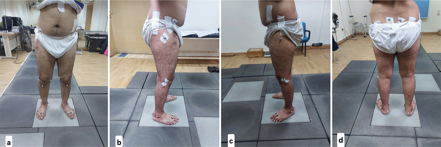 Gait analysis and clinical outcomes of anterior and lateral approach total hip arthroplasty: A prospective randomized study