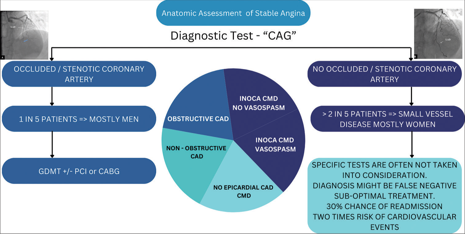 Innovative Directions in Management of Stable Ischaemic Heart Disease