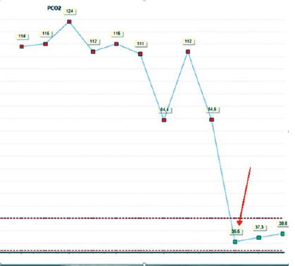 Inadequate ventilation in a patient with tracheal stenosis due to previous intubation
