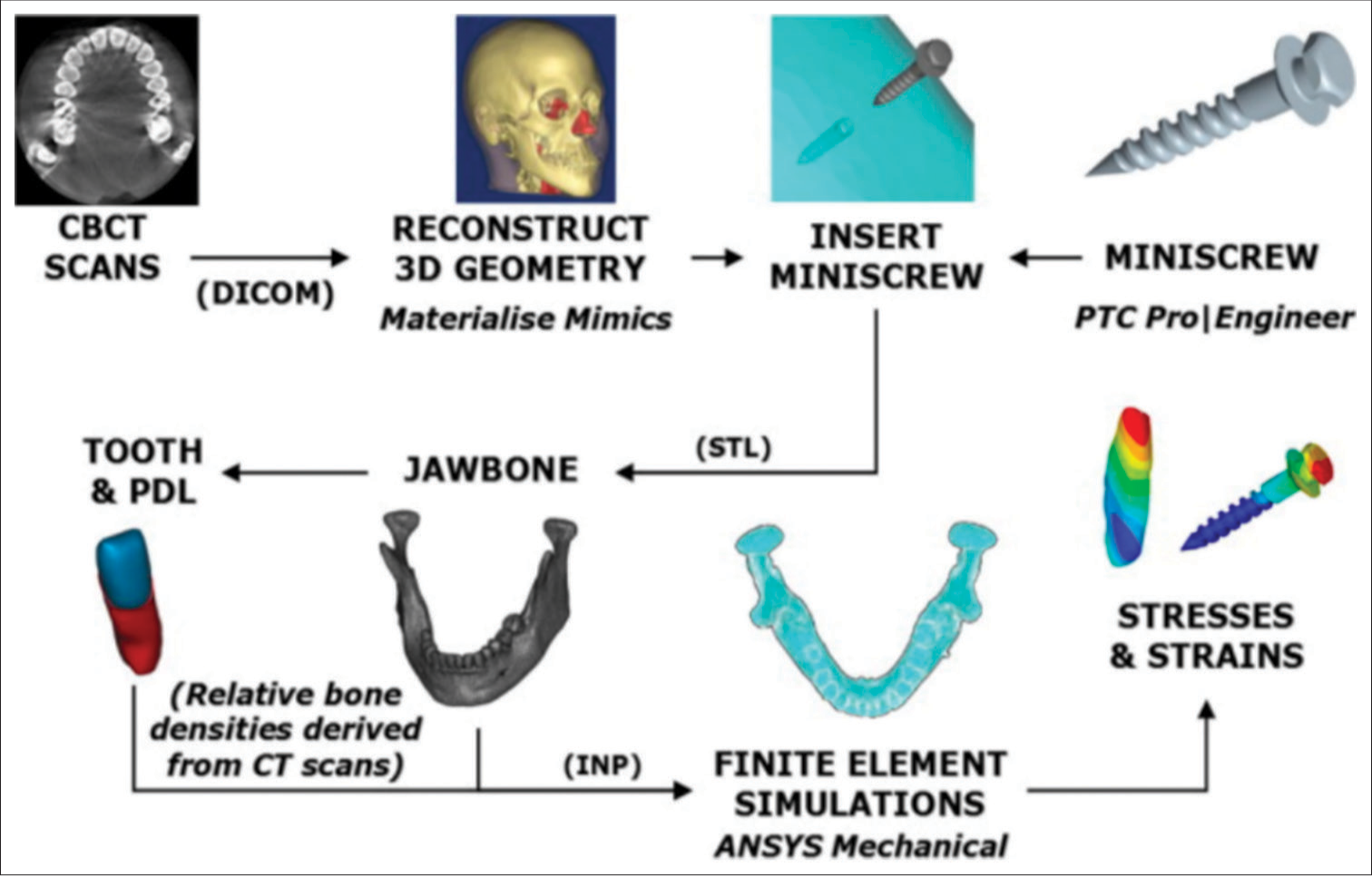 Comparative analysis of stress distribution in implant attachment versus cantilever prostheses