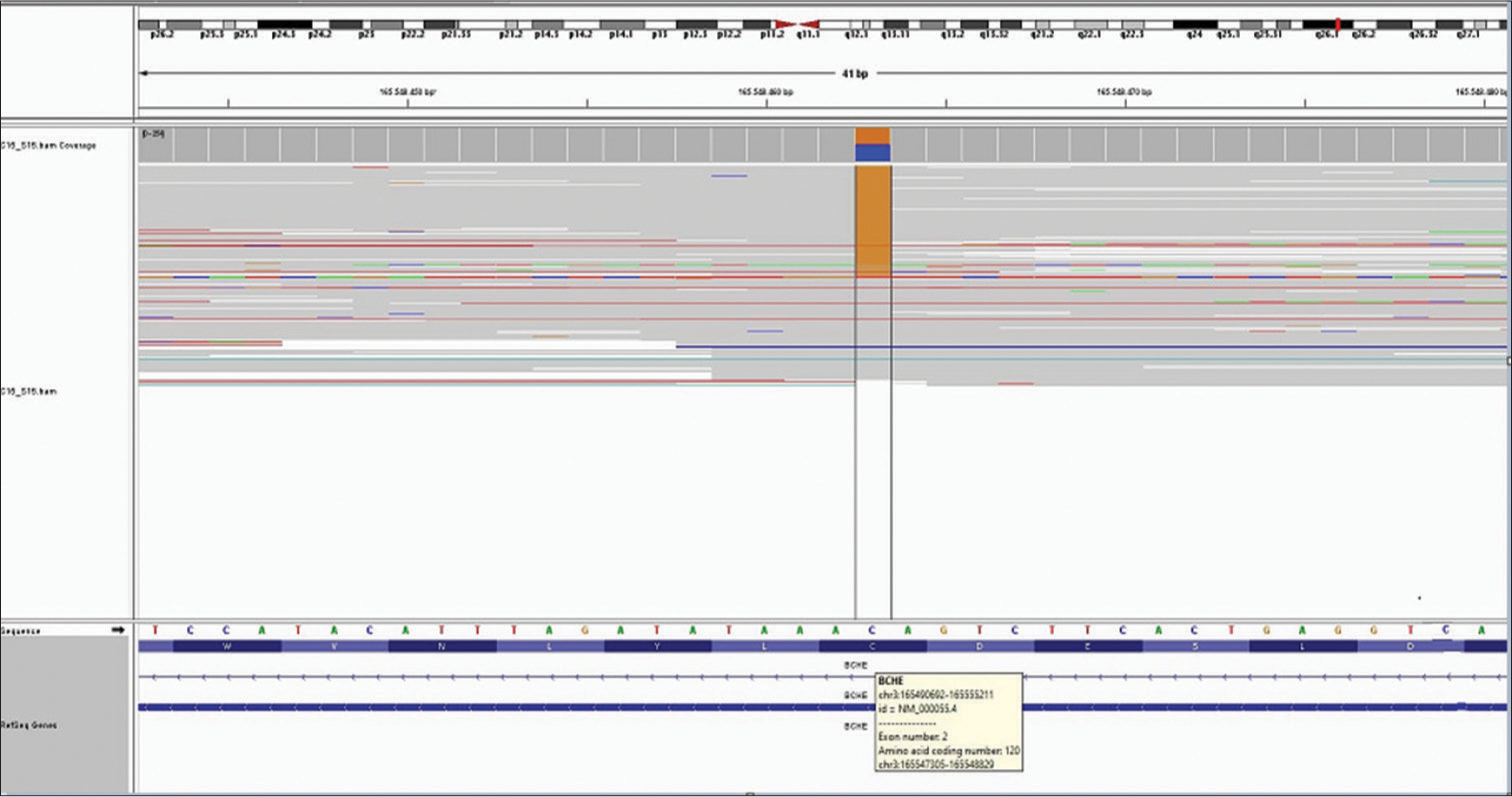 A likely pathogenic variant in the Butyrylcholinesterase gene was found in an agricultural engineer with a low pseudocholine level