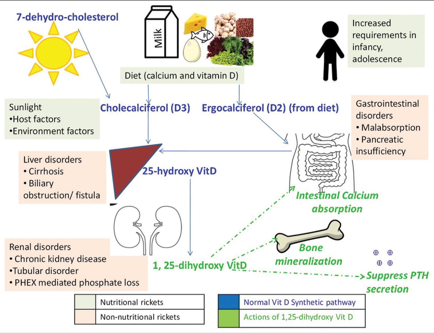 Nutritional Vitamin D deficiency rickets in children – Challenges in diagnosis, management, and prevention