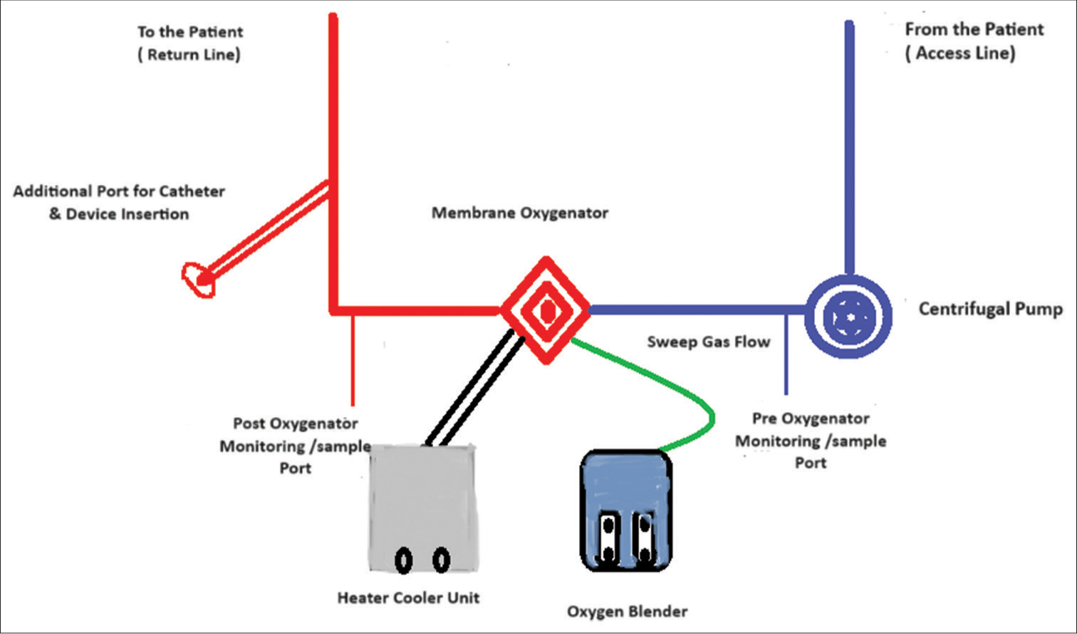 Extracorporeal Membrane Oxygenation Assisted Cardiac Interventions