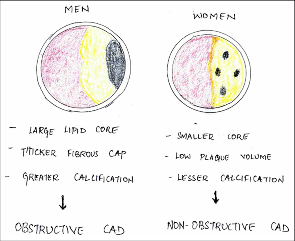 Difference of Coronary Artery Disease in Women and Men in Recent T rials