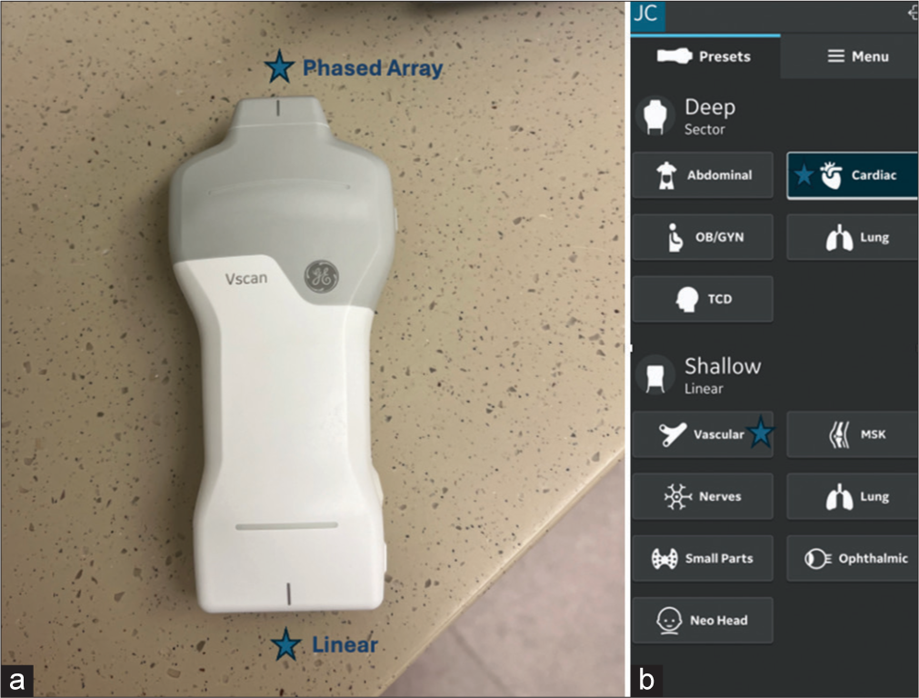 Handheld Ultrasound Device Utilization in Extracorporeal Membrane Oxygenation Initiation