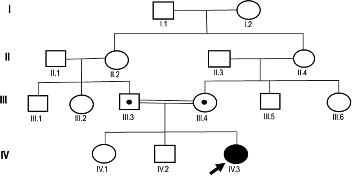 Homozygous germline c.3380C>G missense mutation in PNPLA6 gene in a case of Gordon Holmes syndrome associated with hypogonadotropic hypogonadism, cerebellar ataxia, and juvenile type tremor