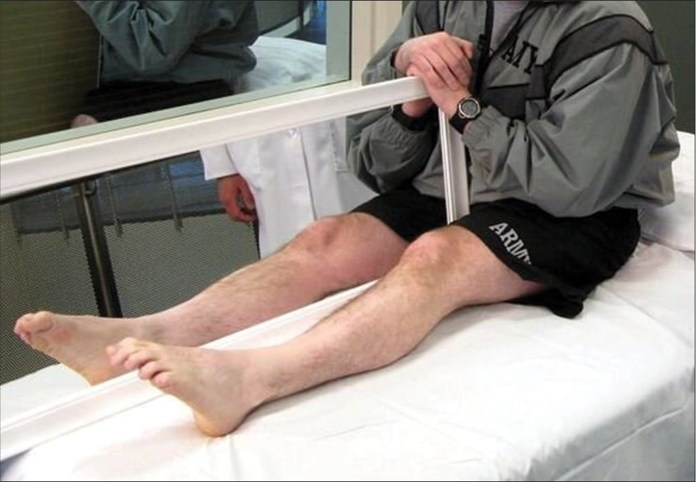 The home-based mirror therapy in the reduction of phantom limb pain in unilateral below-knee amputees