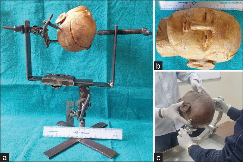 Assessment of verbal (conventional) training versus models training for head frame fixation in neurosurgery