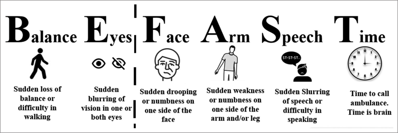 Acute ischemic stroke and the golden hour: Critical updates