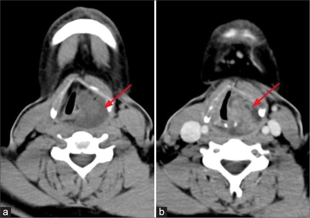 Fighting shadows: Understanding a complex tumor