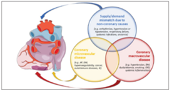 Myocardial infarction in non-obstructive coronary artery (MINOCA) in a young girl with multidrug poisoning