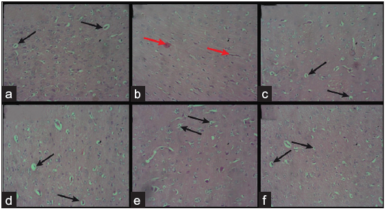 Unveiling the neuroprotective potential of chrysin on the pre-frontal cortex of adult male Wistar rats