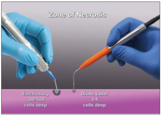 Comparing Different Techniques for Uncovering Dental Implants during Second-Stage Surgery: Tissue Punch versus Laser versus Electrosurgical Unit