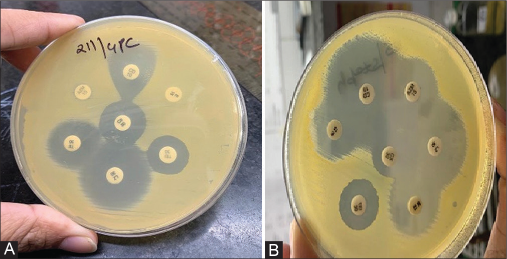 Agreement between azithromycin and erythromycin to determine inducible clindamycin-resistant phenotypes in Staphylococcus aureus isolates