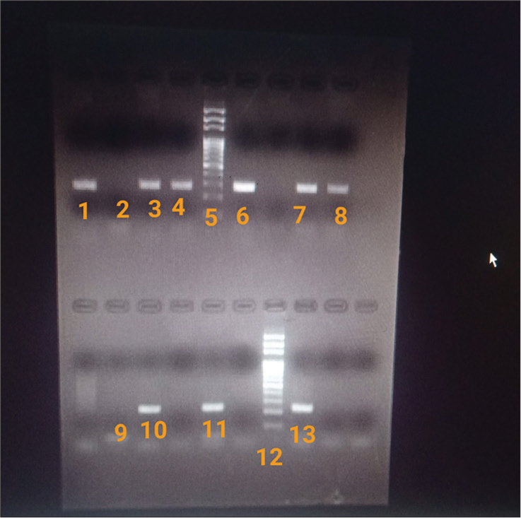 Molecular epidemiology of Carbapenemase-encoding genes and comparative evaluation of carbapenem MIC with genotypic carbapenem resistance in Klebsiella isolates from neonatal sepsis cases