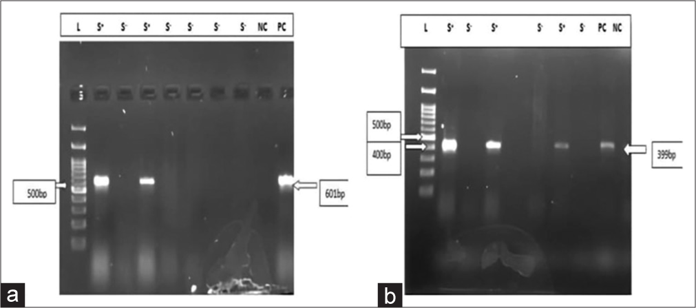 A study to assess the prevalence and risk factors for Clostridioides difficile infection in patients with inflammatory bowel disease in a tertiary care hospital in Northern India