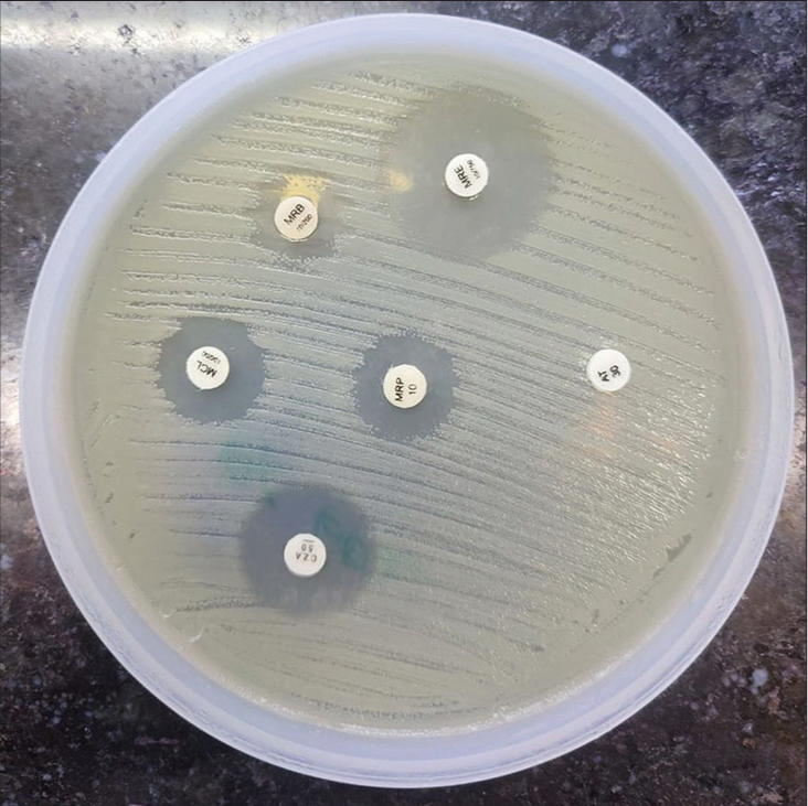 Characterizing carbapenemase production in Enterobacterales through combined disk test and genetic profiling