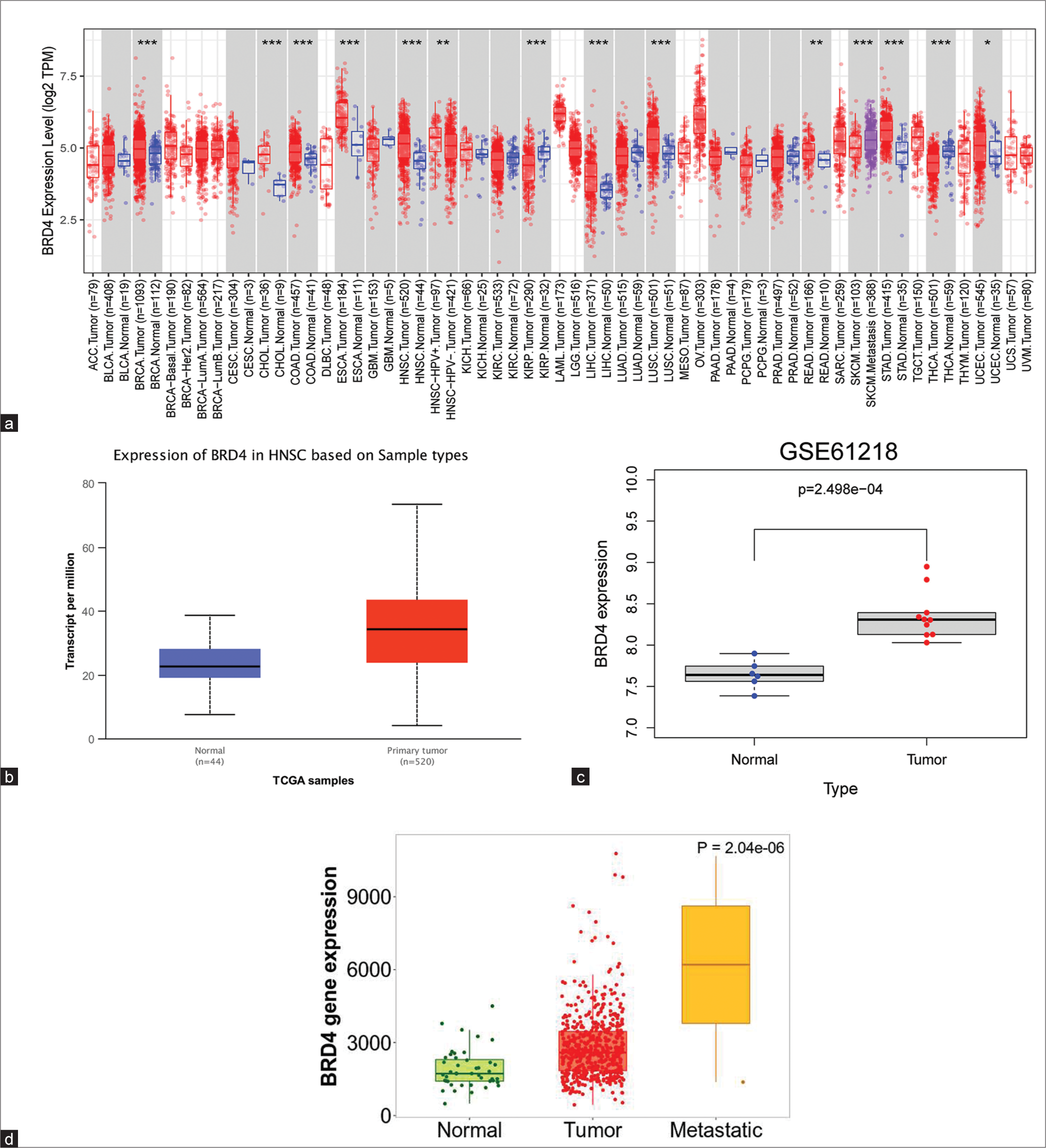 Expression of bromodomain-containing 4 in nasopharyngeal carcinoma: Clinicopathology, prognosis, immunity, and regulatory networks