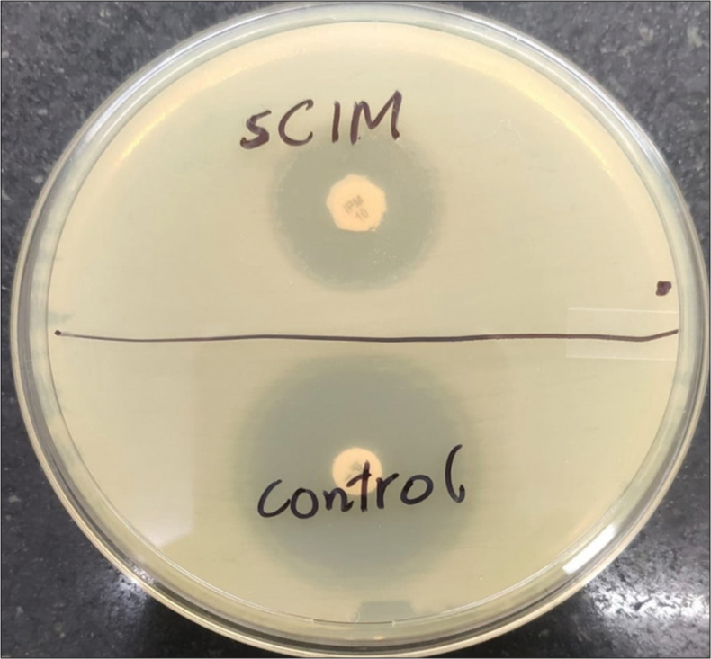 Evaluation of simplified carbapenem inactivation method (sCIM) as a phenotypic method for rapid detection of carbapenemase-producing Enterobacterales: Study from a tertiary care hospital in North India