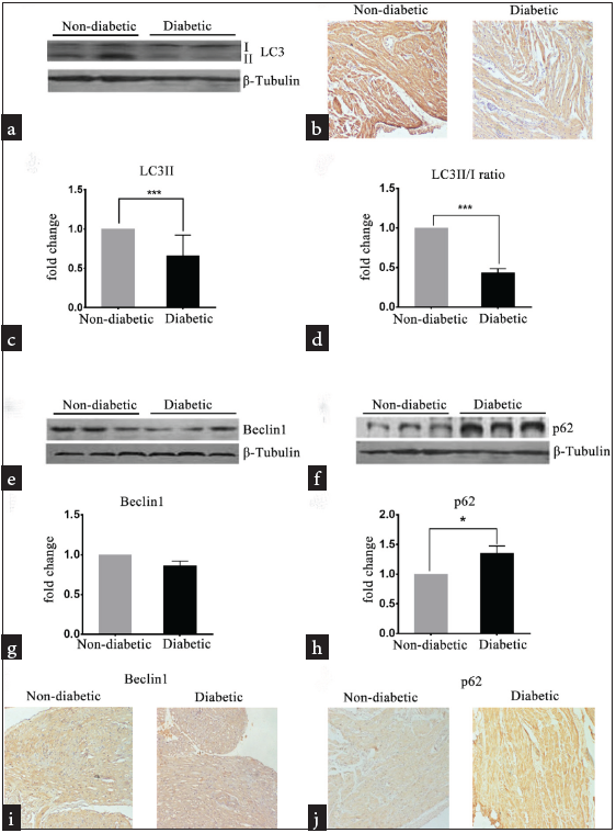 Diminished LC3 expression with unchanged Beclin 1 levels in right atrial appendage tissue of diabetic patients undergoing coronary artery bypass graft