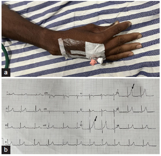 Tetany in a Patient with Gastroesophageal Reflux Disease