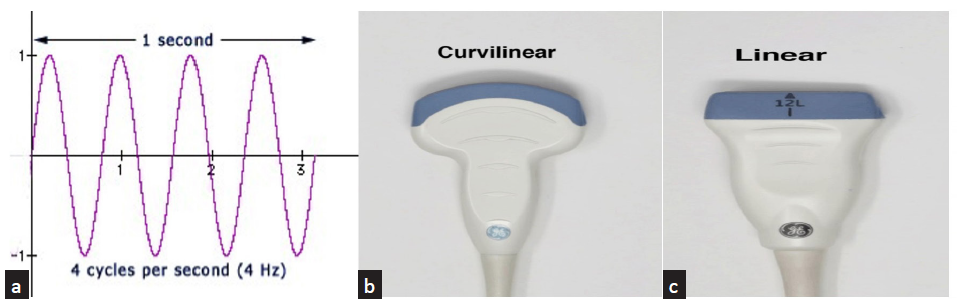 Utility of POCUS (Point of Care Ultrasound) in Renal Transplantation