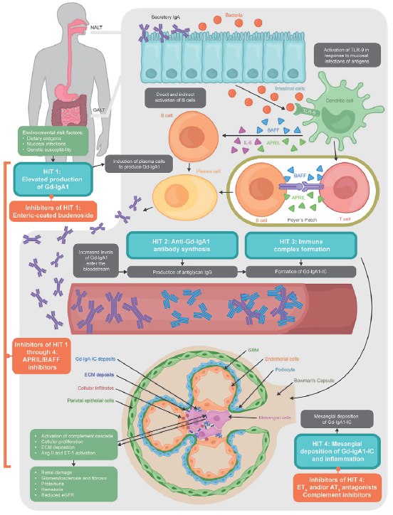 State-of-Art Therapeutics in IgA Nephropathy