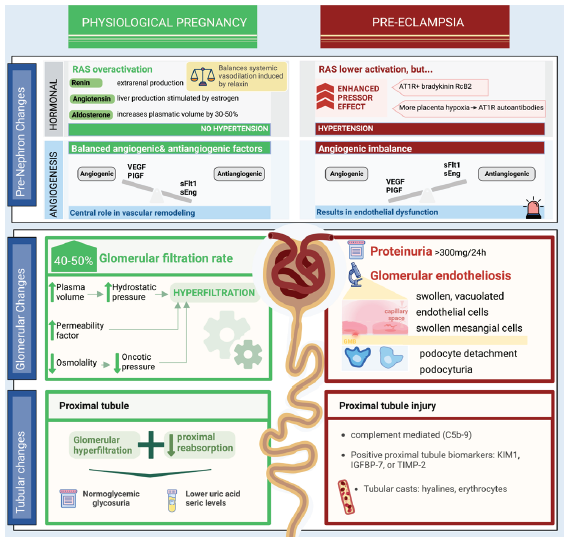 Approach to Glomerular Disease in Pregnancy