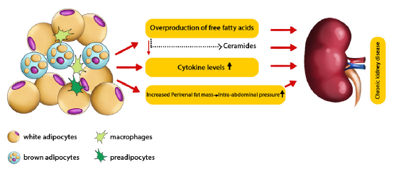 Perirenal Adipose Tissue: Clinical Implication and Therapeutic Interventions