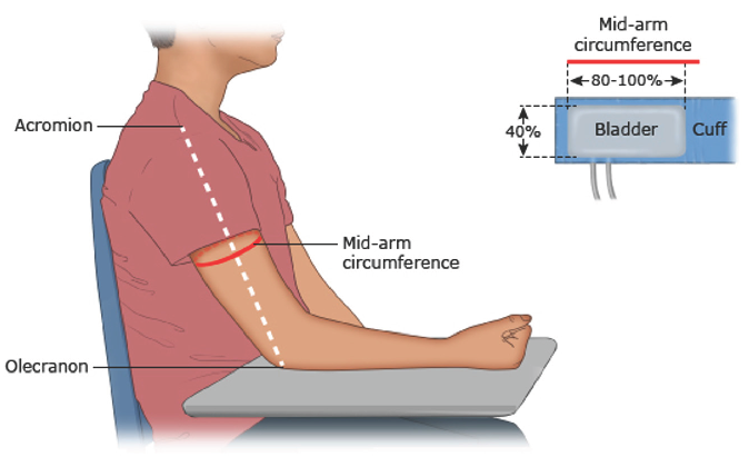 Approach to Diagnosis and Management of Pediatric Hypertension in an Outpatient Setting