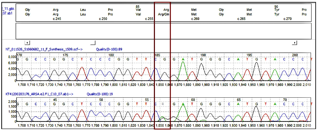 Metachromatic Leukodystrophy and Infantile Onset Nephrotic Syndrome: A Rare Confluence