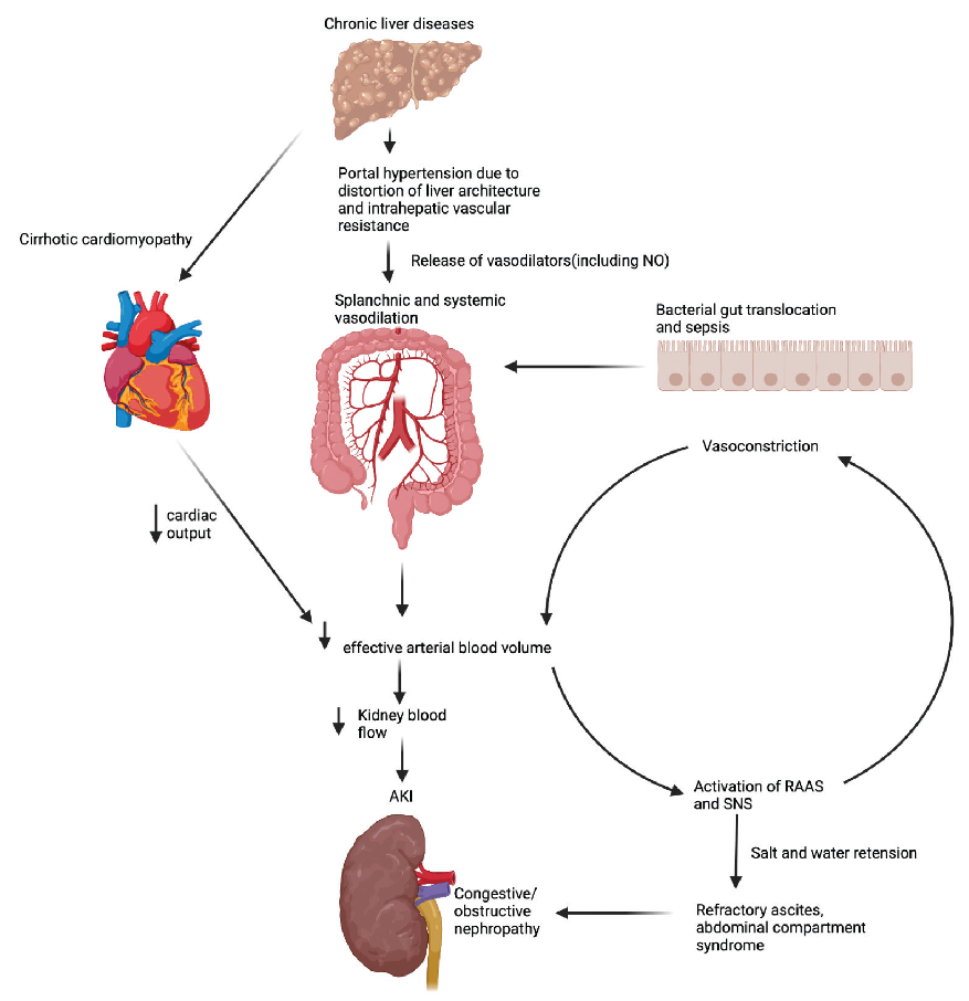 Acute Kidney Injury in Patients with Chronic Liver Disease: A Review