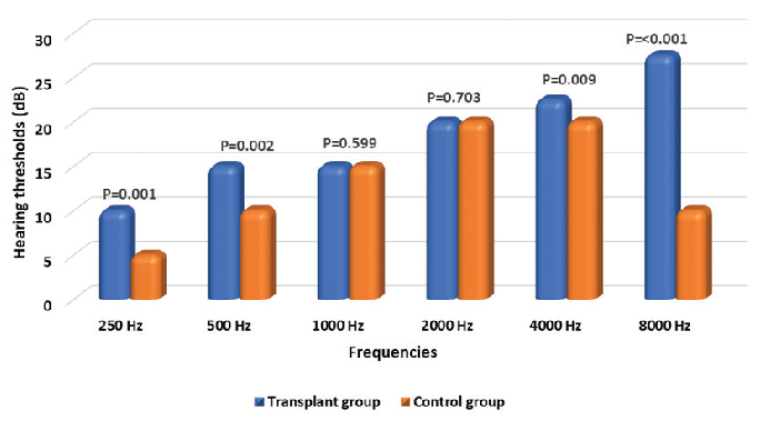 Silent Hearing Loss in Kidney Transplant Patients Receiving Tacrolimus: A Fact or a Myth?