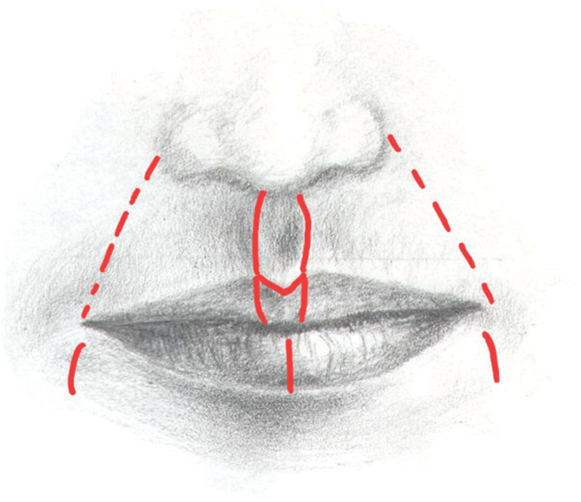 Advancements in lip augmentation: A scoping review exploring novel techniques