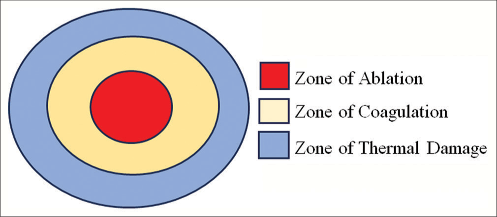 Physics of fractional microneedle radiofrequency – A review