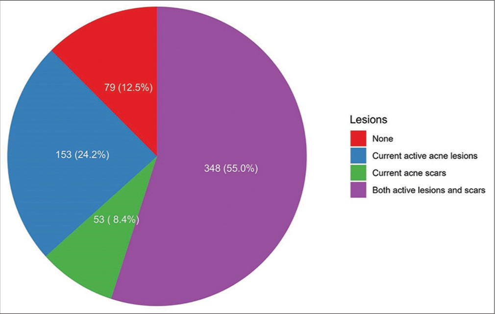 Acne scars impact on the quality of life and the willingness to pay for treatments among adults in Riyadh, Saudi Arabia: A cross-sectional study