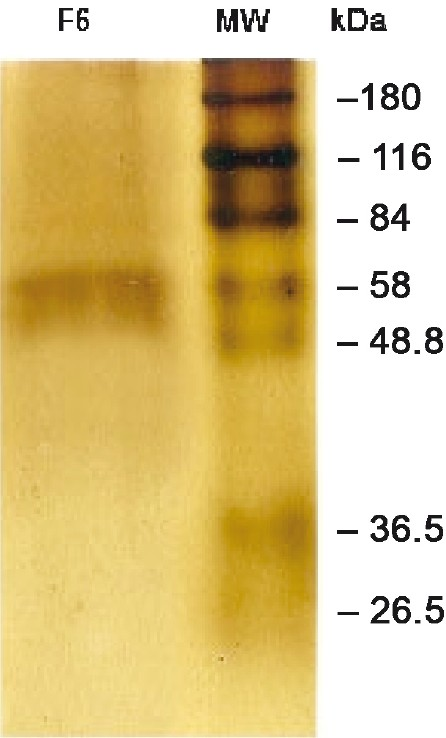 IgG subclass responses to proinflammatory fraction of Brugia malayi in human filariasis