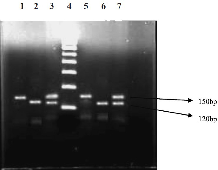 Association of matrix metalloproteinase -7 (-181A/G) promoter polymorphism in chronic pancreatitis